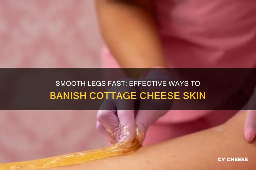 how to get rid of cottage cheese legs fast