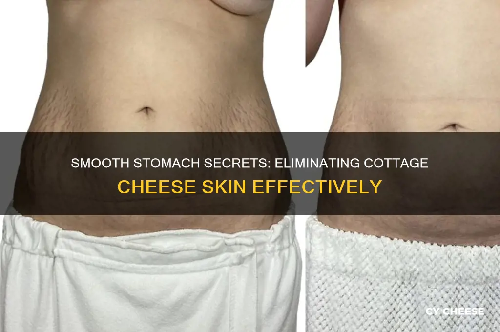 how to get rid of cottage cheese on stomach