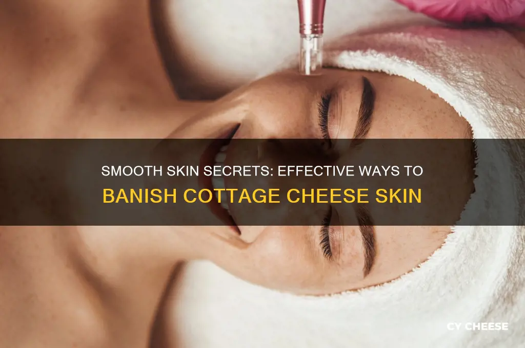 how to get rid of cottage cheese skin
