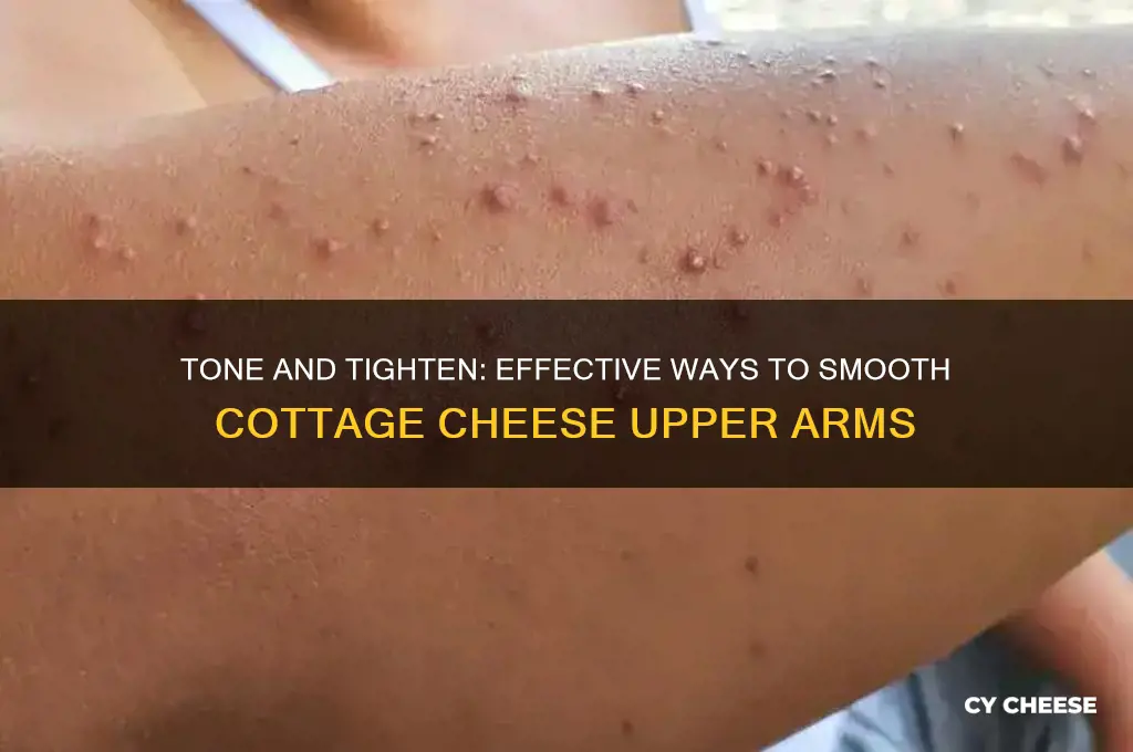 how to get rid of cottage cheese upper arms