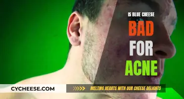 Blue Cheese and Acne: Is There a Connection?