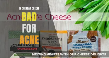 Cheese Conundrum: Cheddar's Impact on Acne-Prone Skin