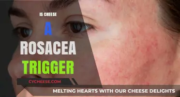 Cheese and Rosacea: Uncovering the Truth Behind the Trigger