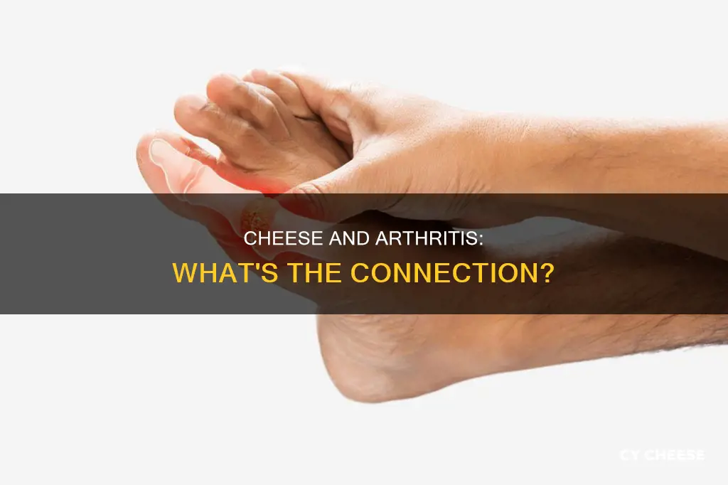 is cheese bad for artheritis