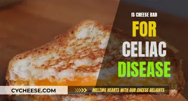 Cheese and Celiac: What's Safe to Eat?