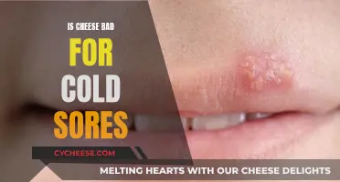 Cheese and Cold Sores: A Bad Combination?