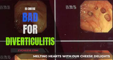 Cheese and Diverticulitis: What You Need to Know