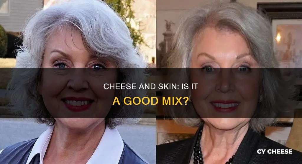 is cheese bad for face