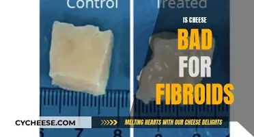 Cheese and Fibroids: What's the Connection?