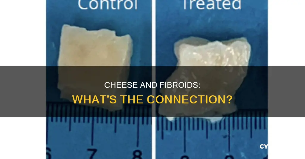 is cheese bad for fibroids