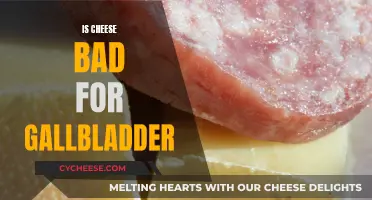 Cheese and Gallbladder: A Risky Relationship