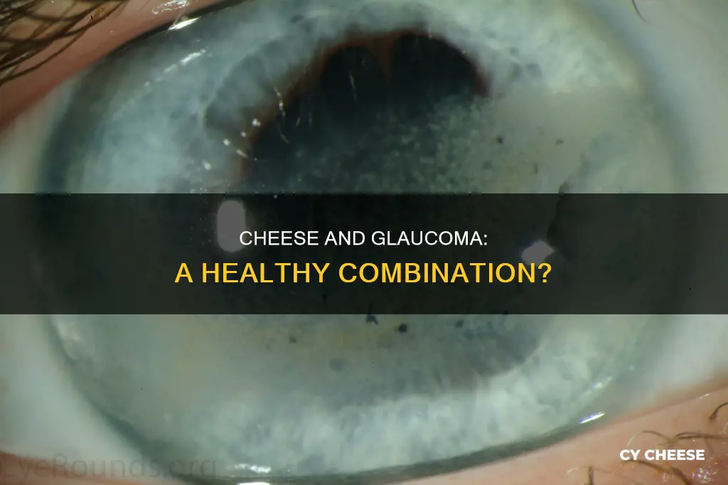 is cheese bad for glaucoma