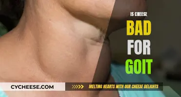 Cheese and Goiter: What's the Connection?