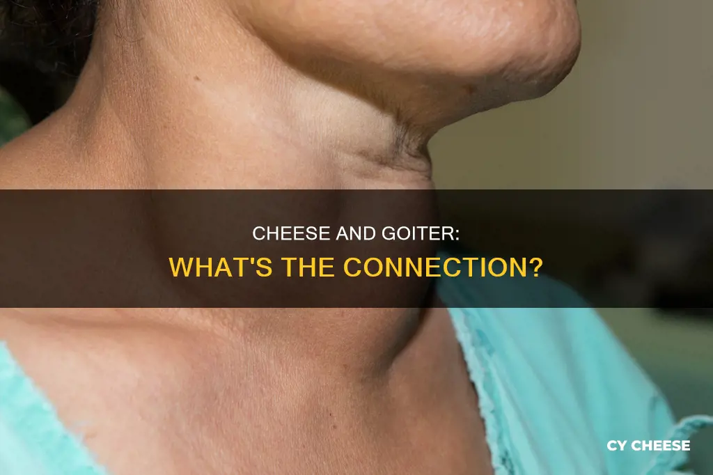 is cheese bad for goit