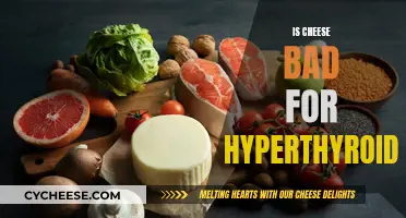 Cheese and Hyperthyroidism: What's the Connection?
