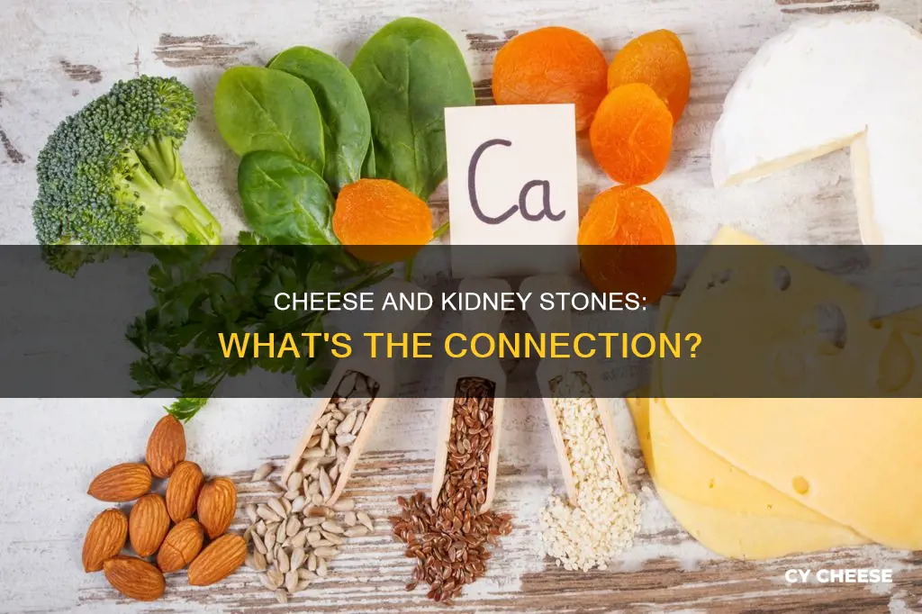 is cheese bad for kidney stones