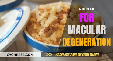 Cheese and Macular Degeneration: A Risky Pair?