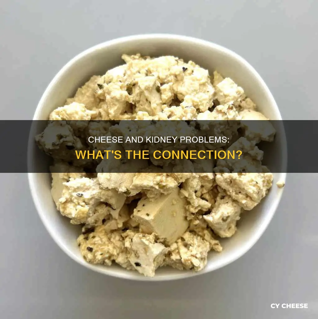 is cheese bad for people with kidney prp