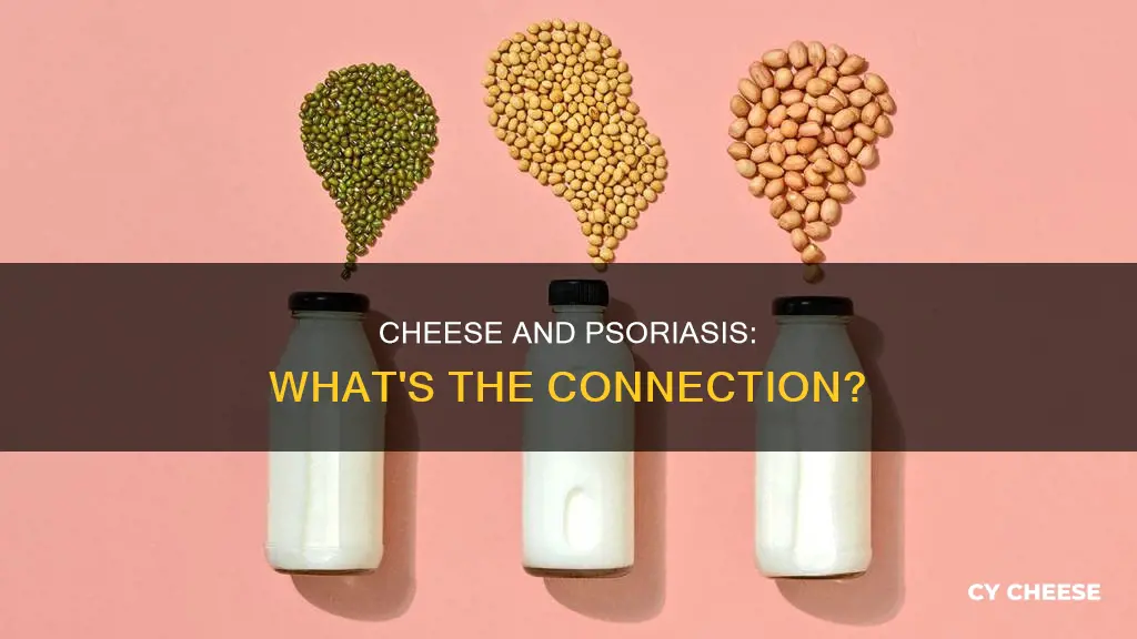 is cheese bad for psoriasis