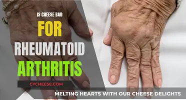 Cheese and Rheumatoid Arthritis: What's the Connection?