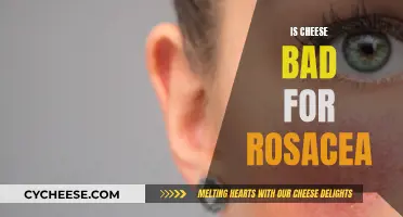 Cheese and Rosacea: What's the Connection?