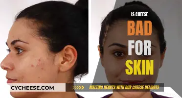 Cheese and Skin: Friends or Foes?