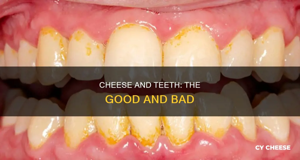 is cheese bad for teeth