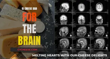 Cheese and Brain Health: Is It a Concern?