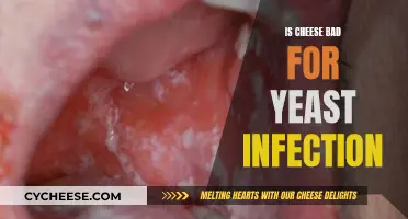 Cheese and Yeast Infections: What's the Connection?