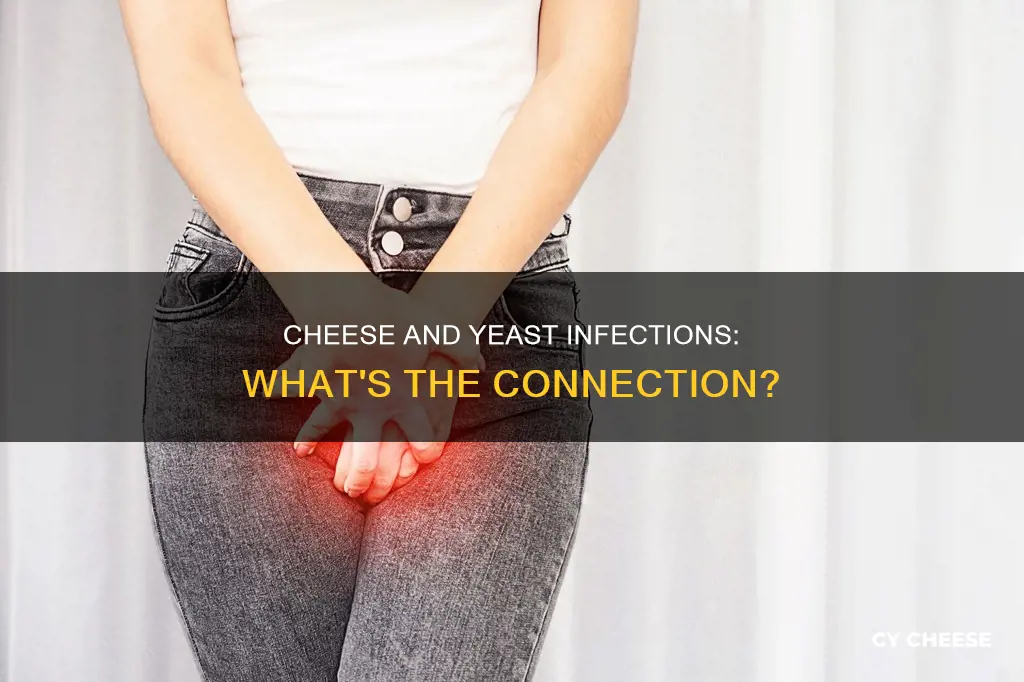 is cheese bad for yeast infection