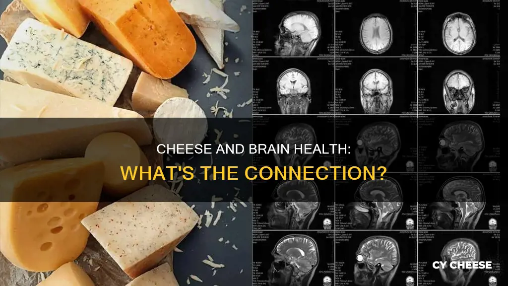 is cheese bad for your brain
