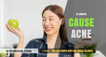 Does Cheese Trigger Acne? Unraveling the Dairy-Skin Connection