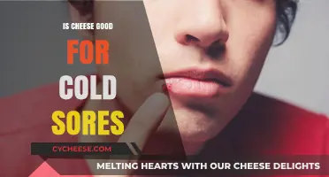 Cheese and Cold Sores: A Healthy Combination?