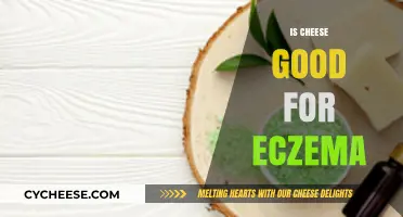 Cheese and Eczema: A Healthy Relationship?