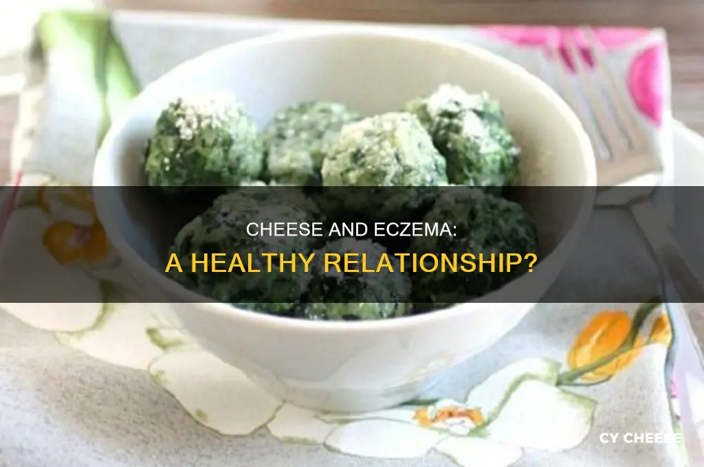 is cheese good for eczema