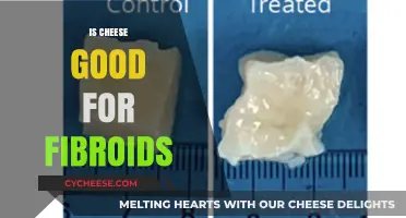 Cheese and Fibroids: A Healthy Relationship?