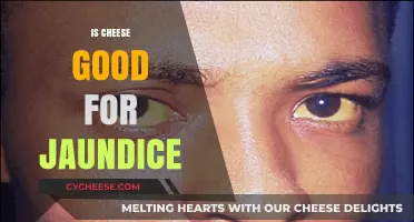 Cheese and Jaundice: A Healthy Combination?