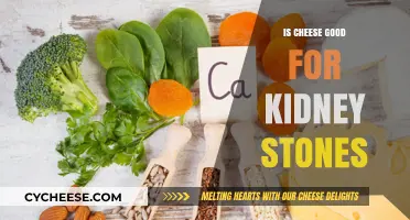 Cheese and Kidney Stones: A Healthy Combination?
