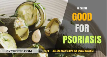 Cheese and Psoriasis: A Healthy Relationship?