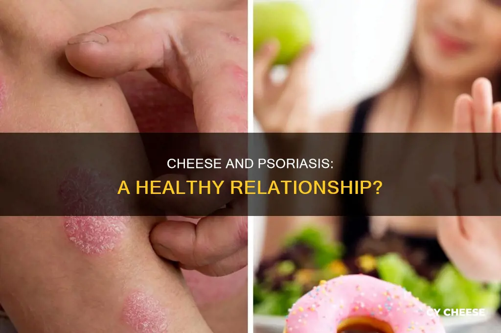 is cheese good for psoriasis