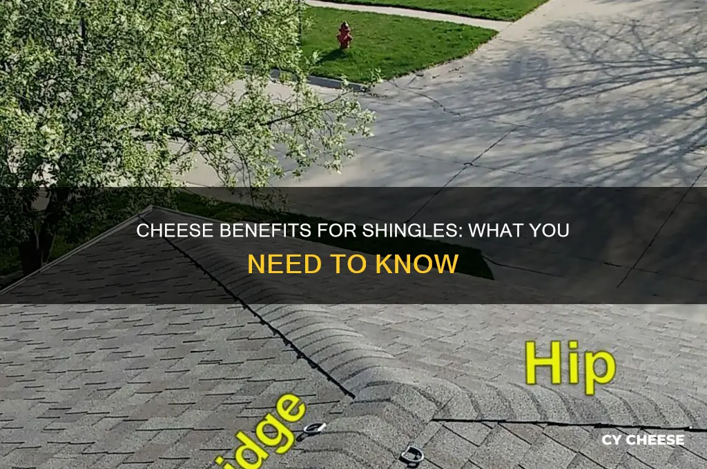 is cheese good for shingles