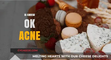 Can Cheese Trigger Acne? Debunking Myths and Facts for Clear Skin