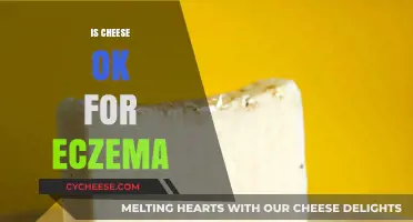 Can Cheese Worsen Eczema? Unraveling the Diet-Skin Connection