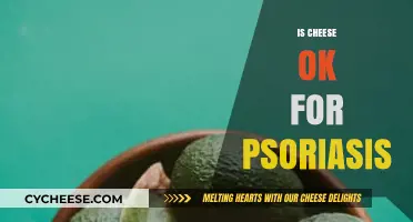 Can Cheese Affect Psoriasis? Diet Tips for Skin Health