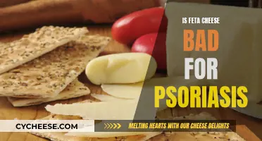 Feta Cheese and Psoriasis: A Healthy Diet Myth Debunked