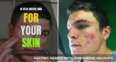 Feta Cheese: Friend or Foe for Skin Health?