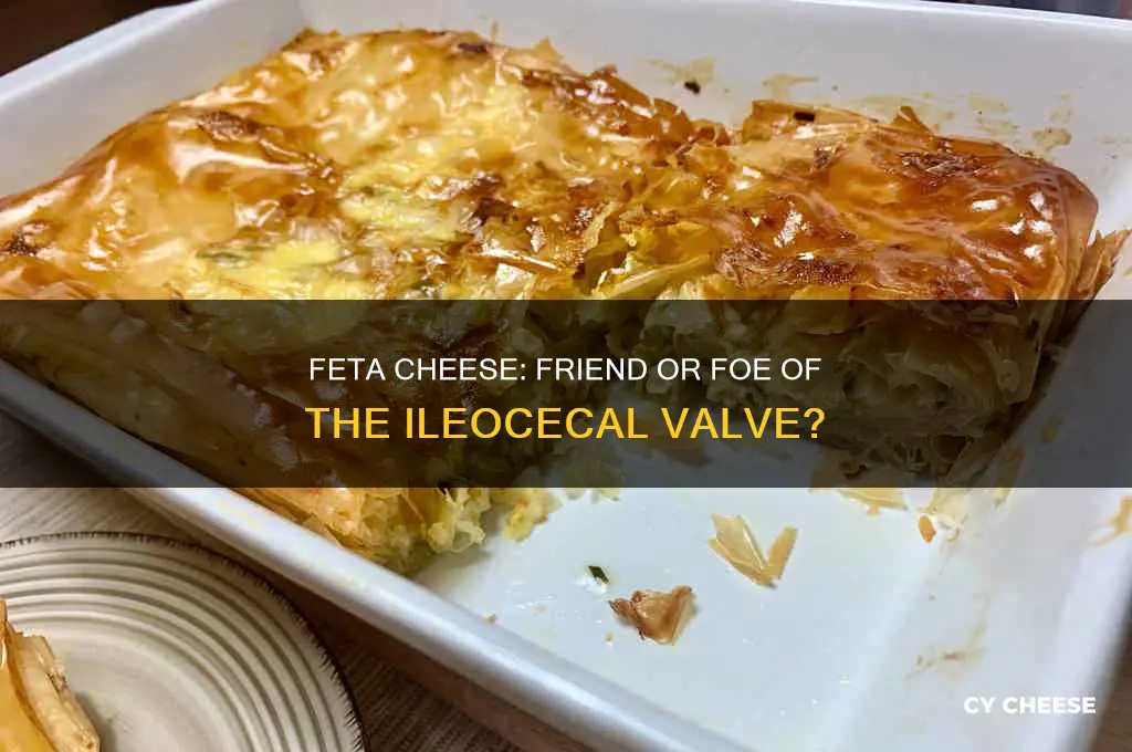 is feta cheese good for illeoceccal valve diet