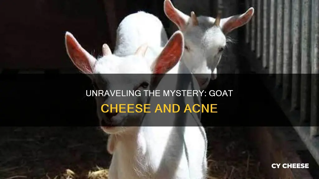 is goat cheese bad for acne