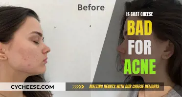 Goat Cheese and Acne: Is There a Connection?