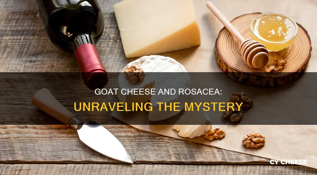 is goat cheese bad for rosacea